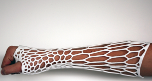 3d printed cast